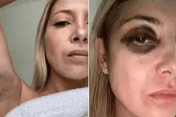 Before and After Meme