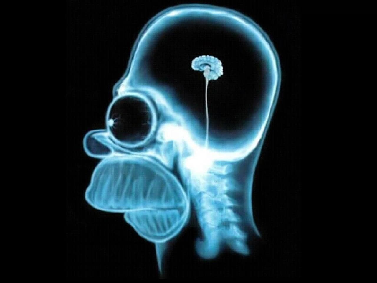Homer Simpson X-Ray Reveals Tiny Brain